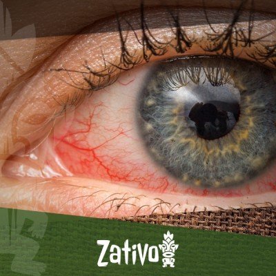 Rote Augen Und Cannabis: Warum Ist Das So Und Was Kann Man Dagegen Tun?